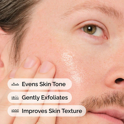 Mandelic Acid 10% + HA: Improve Skin
Clarity and Texture